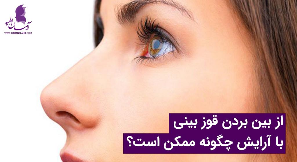 از بین بردن قوز بینی با آرایش چگونه ممکن است؟