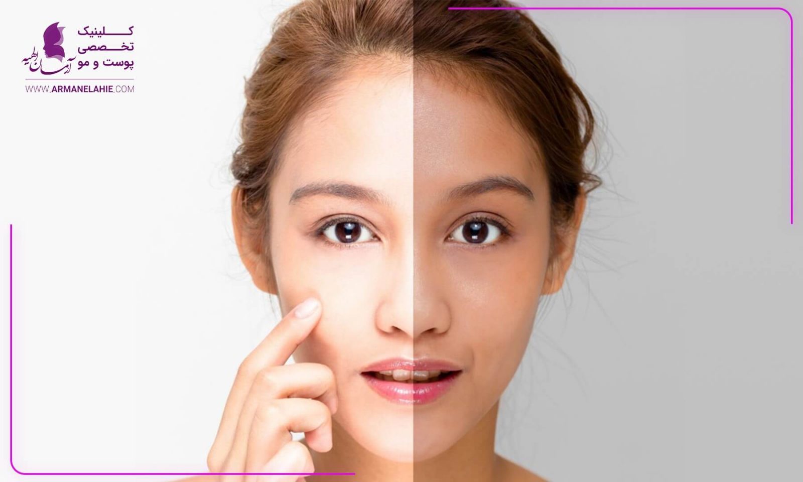 11 روش برای روشن شدن پوست صورت و بدن