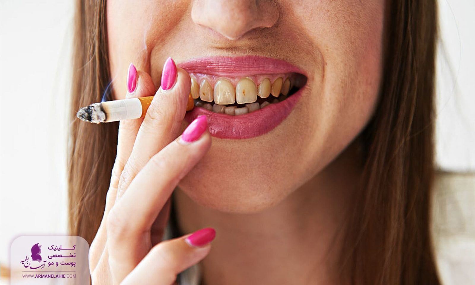 10 مورد از عوارض سیگار و قلیان بر پوست