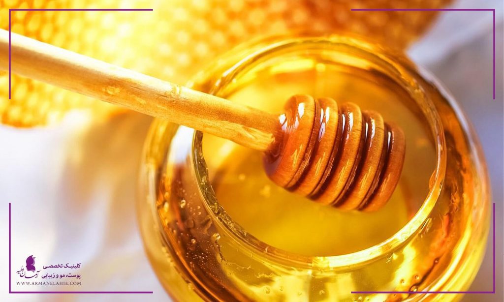 درمان کیست مویی با عسل