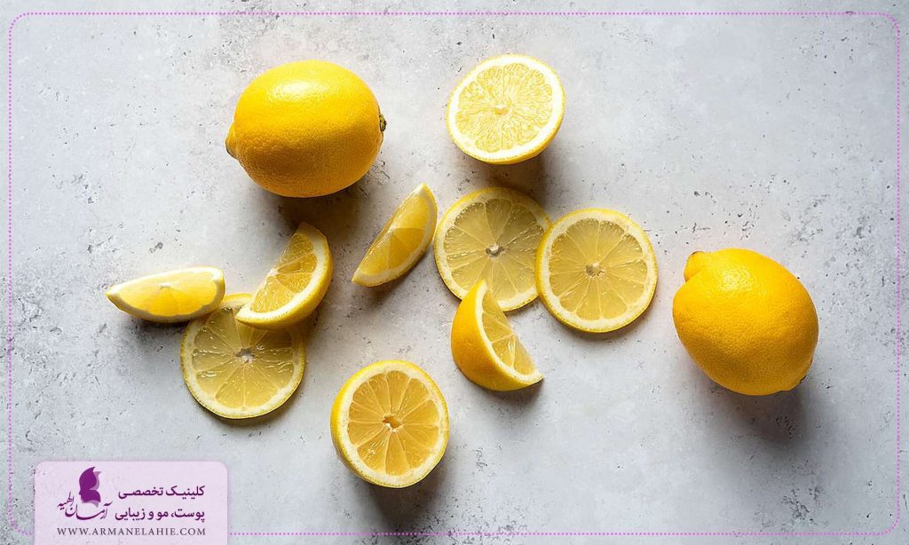 درمان لک های قهوه ای با لیمو