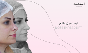 لیفت بینی با نخ در کمتر از ده دقیقه کلینیک تخصصی آرمان الهیه